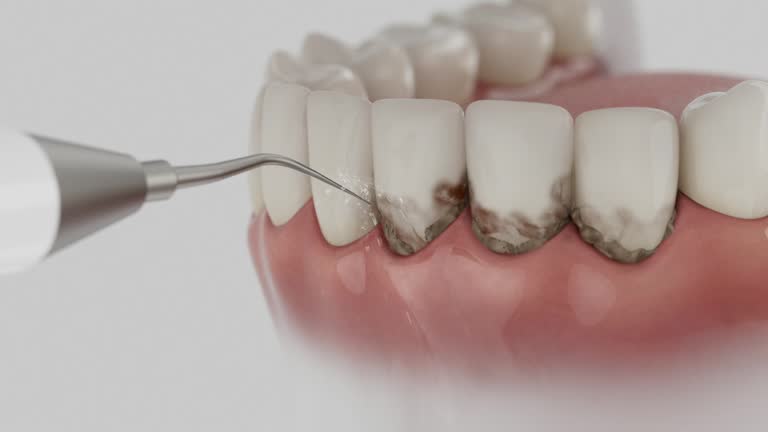 Trusted Tooth Extraction service in Kingfisher, OK - Dentist Open Now